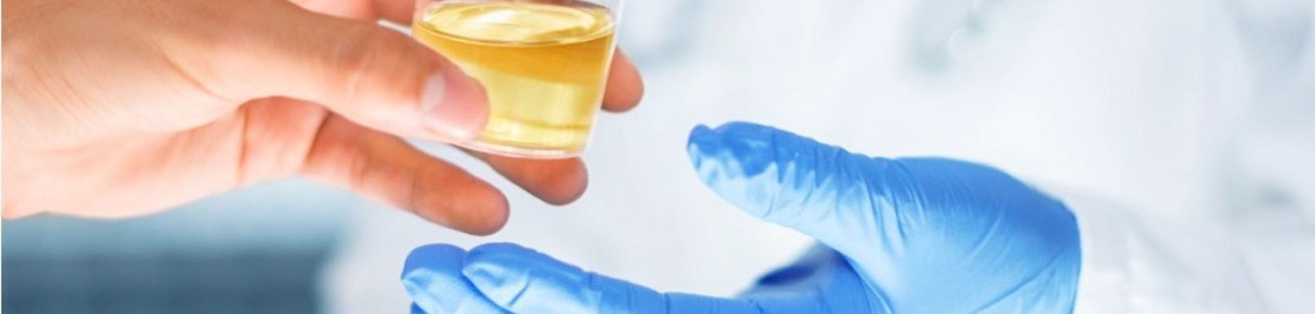 Urine Drug Testing Pallara