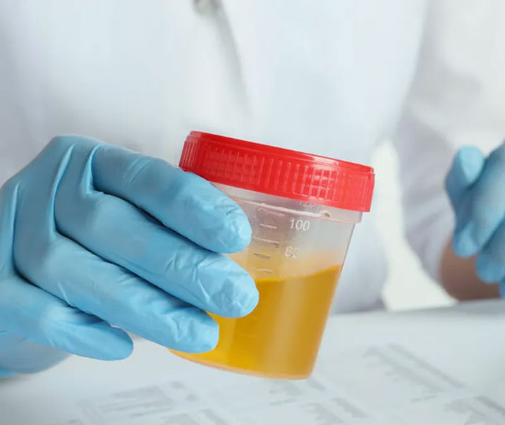 Urine-Drug