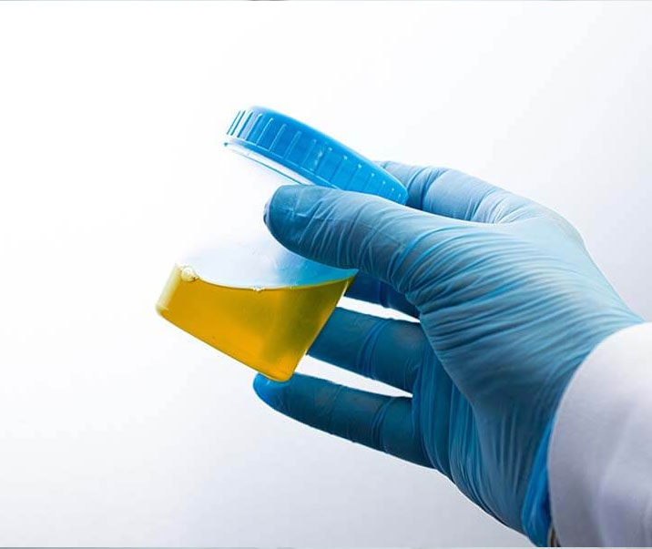 Urine-Drug3