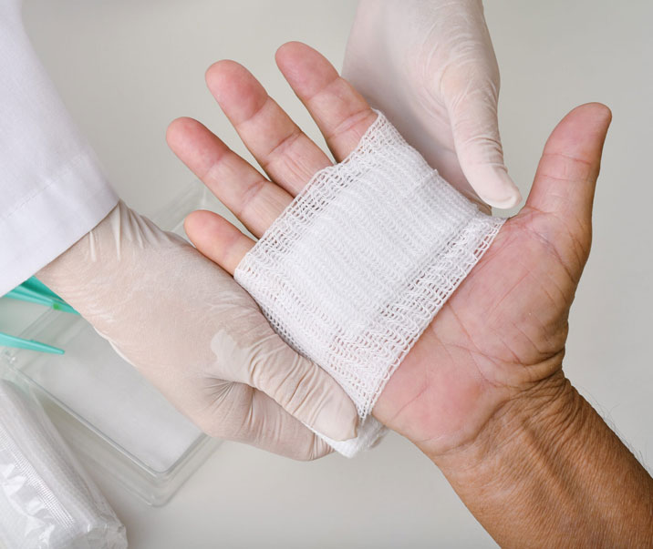 Wound-Care-dressing
