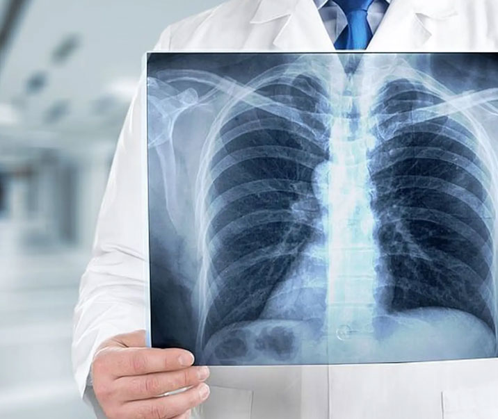 X-Rays