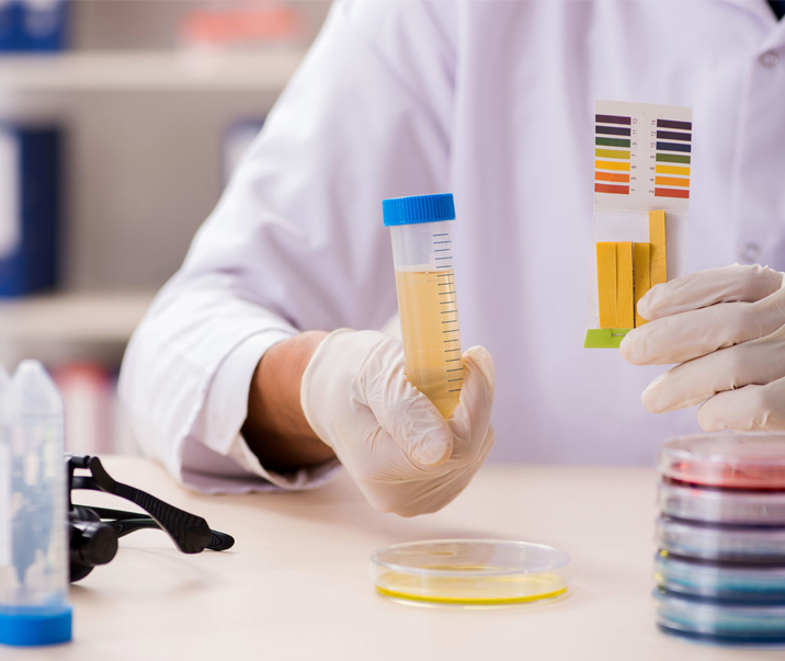 urine test img 1