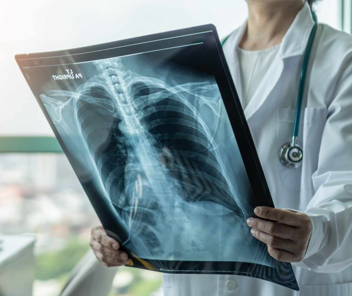 xray img 1