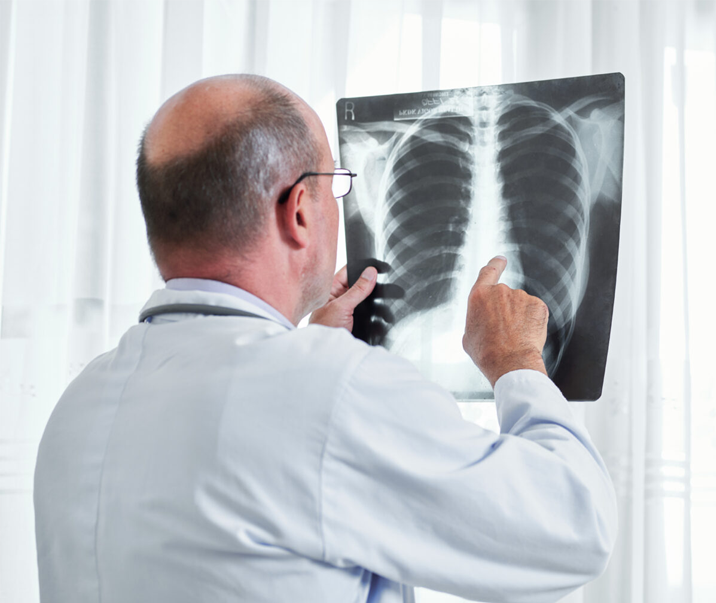 xray img 2